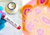 Nipah virus is scaring Bengal! 2 new suspected patients found, admitted to hospital