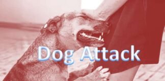 Dog attacks female passenger in Jaipur airport, leg bleeding