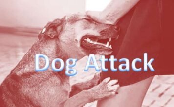 Dog attacks female passenger in Jaipur airport, leg bleeding